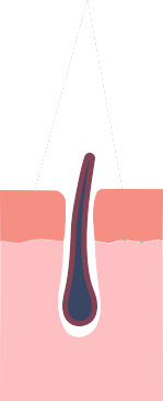 How Laser Energy Targets the Hair Follicle