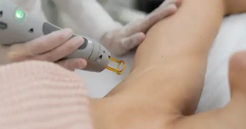 During Your Laser Hair Removal Treatment
